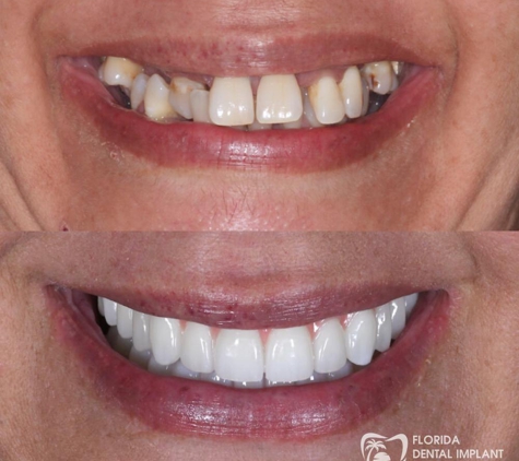 Florida Dental Implant Studio - Ponte Vedra Beach, FL