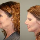 Kalos Facial Plastic Surgery LLC - Physicians & Surgeons, Plastic & Reconstructive