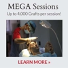 Maxim Hair Restoration gallery