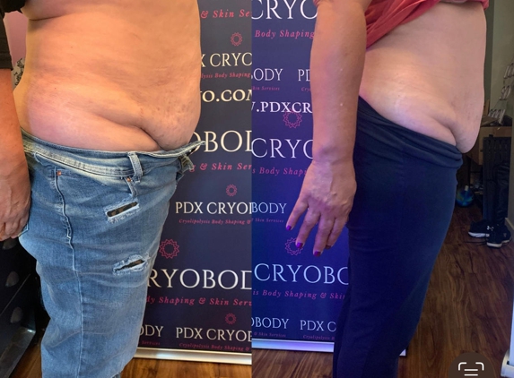 PDX Cryobody - Lake Oswego, OR