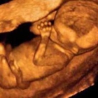 Fetal Memories 2D 3D 4D Ultrasound