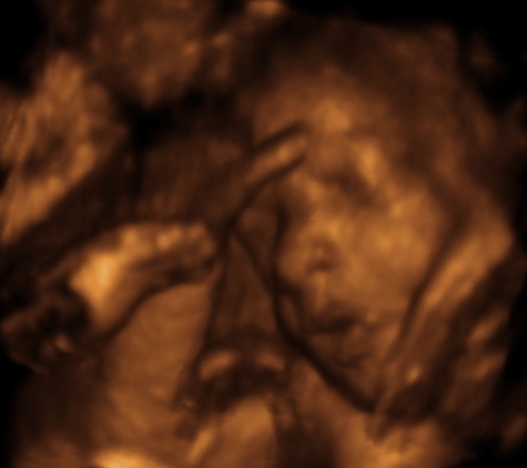 Sneak-A-Peek Prenatal Imaging of Mobile - Mobile, AL