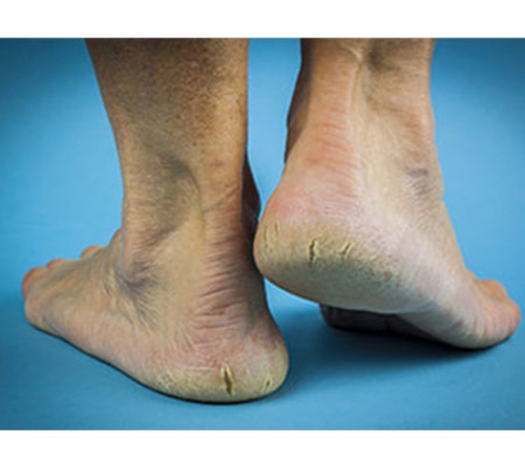 Mobile Podiatry Service - Seaton, SA