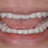 Orange County Prosthodontics gallery