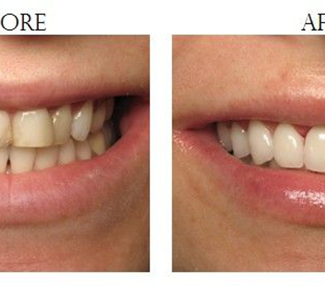 StarBrite Dental-Dr. Munira Lokhandwala DDS, FAGD, FICOI - Fremont, CA