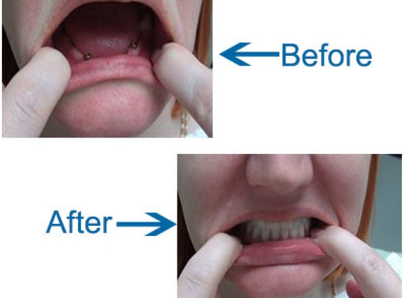 Cronulla Denture Care