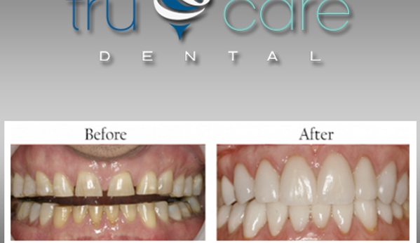 Tru Care Dental - Albuquerque, NM