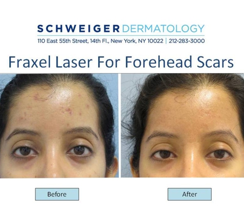 Schweiger Dermatology Group - Broadway - New York, NY