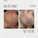 Bare Complexion Studio - Clinics
