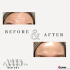 Wilkes Rejuvenation MD