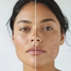 Advanced Skin Technology gallery