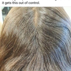 Lice Clinics of America - S. San Francisco