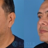 Bader Facial Plastics gallery