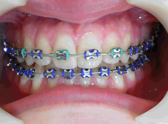 Santelli Orthodontics - Boca Raton, FL