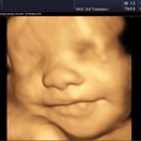 Heavenly 3D 4D Ultrasounds-Upland - Medical Centers