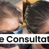 SMP Scalp Micropigmentation CA (SMPCA Academy) gallery