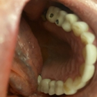 Hayan Dental Group: Dr. Charles Kim, D.D.S.
