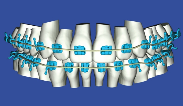 Pitner Orthodontics of Columbia - Columbia, SC