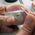 Tri-Star Denture