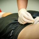 Release Physical Therapy Washington DC - Physical Therapists