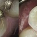 Cox Family Dentistry - Implant Dentistry