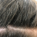 Lice Clinics of America - Modesto - Medical Clinics