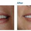 Dupage Dental Smiles gallery