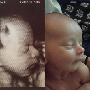 You are my Sunshine 3D/4D Ultrasound & Photography - Enid, OK