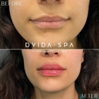 Dvida Med Spa