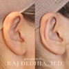 Raj Dedhia, MD Facial Plastic Surgery gallery