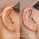 Raj Dedhia, MD Facial Plastic Surgery