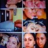 THE FACIAL COMPANY ACNE CLINIC gallery