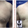 Boston Gynecomastia Specialists gallery