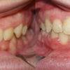 Allegany Orthodontics gallery