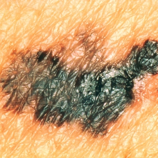 Port Macquarie Skin Cancer Clinic - Port Macquarie, NSW