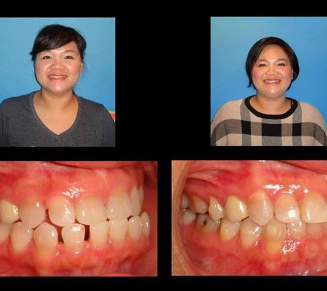 Aloha Orthodontics - Las Vegas, NV