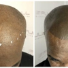 Full Micropigmentation gallery