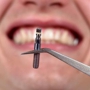 Arrow Dental Care