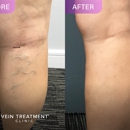 Vein Treatment Clinic | Rockville Centre - Medical Centers
