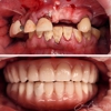 Elgin Dental Implants gallery