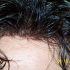 Marlene Glass Hair Restoration Inc