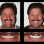 Lehigh Valley Smile Designs - Michael A. Petrillo DMD, PC - CLOSED