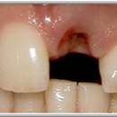 LaGrange Dental - Implant Dentistry