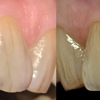 Enhance Family Dental gallery