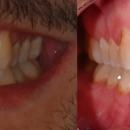 Tyler and Yun Family Dental - Implant Dentistry