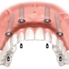 Progressive Periodontics and Implant Dentistry