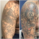MEDermis Laser Clinic - San Antonio - Tattoo Removal