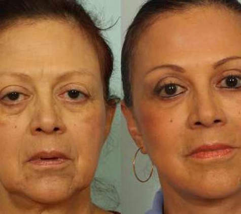 El Paso Cosmetic Surgery - El Paso, TX