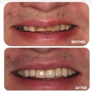 Paramus Dental Arts - Teeth Whitening Products & Services