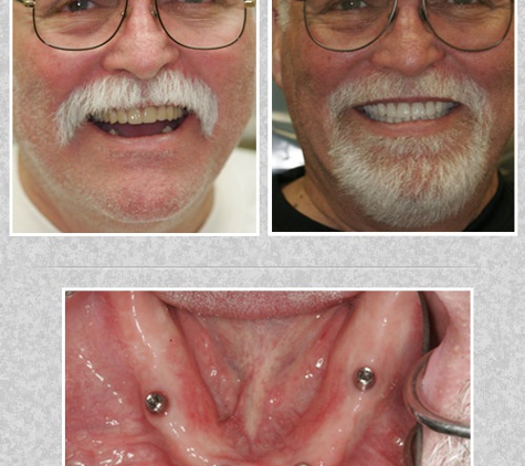 Emergency Dental & Dentures 24-7 - Lighthouse Point, FL